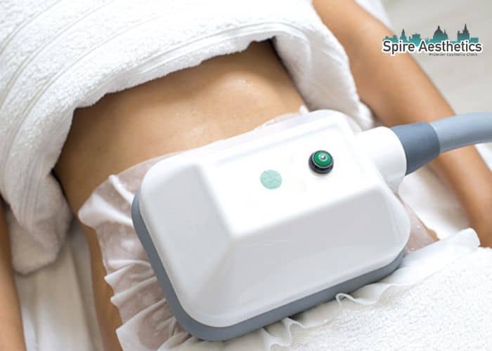 Shift Those Extra Pounds: How Fat Freezing Can Help You Slim Down Clydebank