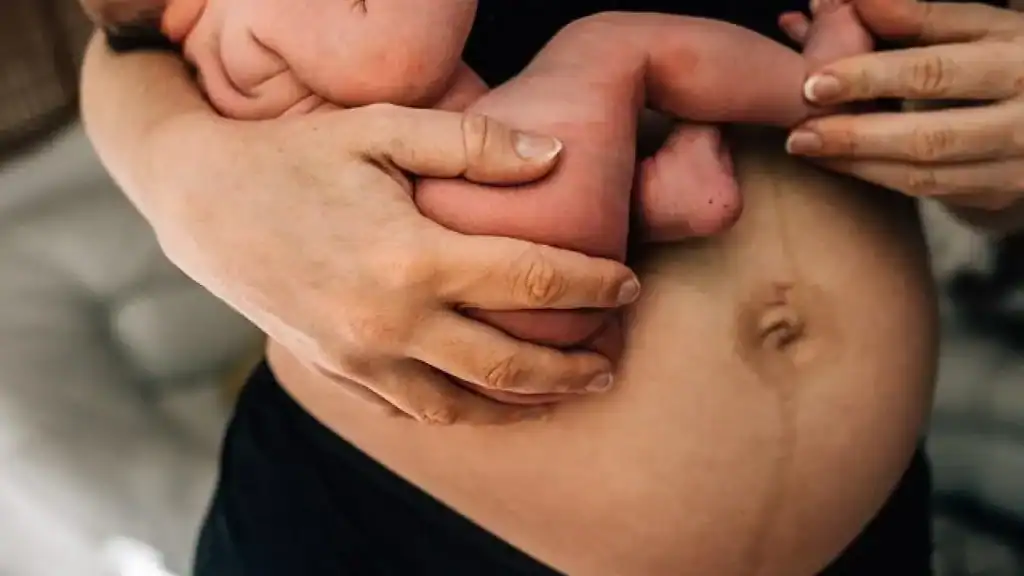 Why Is My Stomach Still Big After Pregnancy Clydebank?
